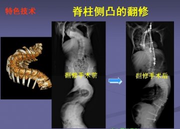 第306医院-全军脊柱外科中心