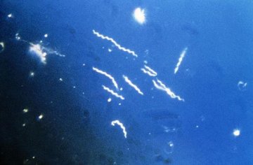 莱姆病致病菌偷梁换柱 躲避免疫系统追杀