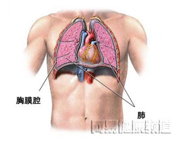 气胸治疗术