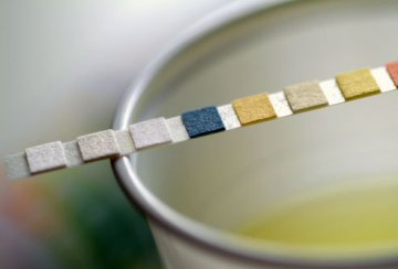 女性健康：女性应如何预防尿路感染