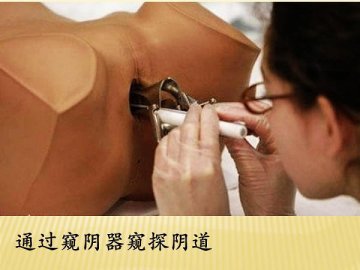 实拍妇科医师实习阴道检查
