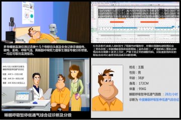 睡眠呼吸暂停低通气综合征