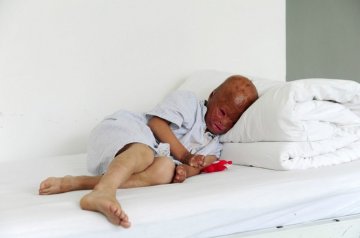 奥特曼男孩王小鹏在北京住院后的日子