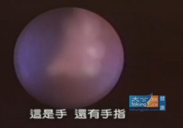 实拍堕胎手术全过程 呼吁珍惜生命