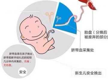 准妈一定不知道 脐带血还有这些大作用！