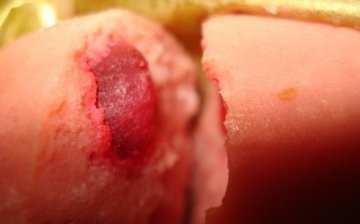 金锣火腿肠惊现蛆虫 腐烂变质致消费者中毒