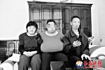 20岁女孩患怪病巨乳重10多公斤垂到肚脐处