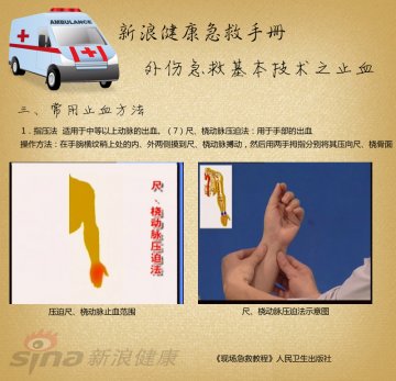 指压止血方法：尺、桡动脉压迫法