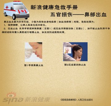 鼻部出血急救