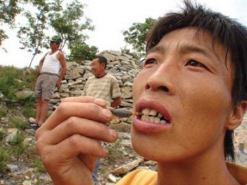 男子爱吃活蝎子身体常年发凉