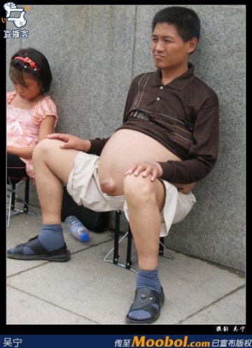全球最恐怖的67种怪病