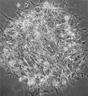 胚胎干细胞遭遇专利危机