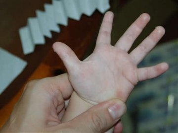 立春后，手心脱皮发痒怎么办