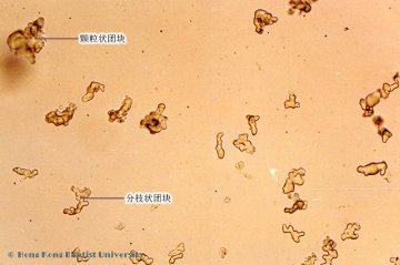 茯苓（Fuling）中药材粉末显微鉴别照片
