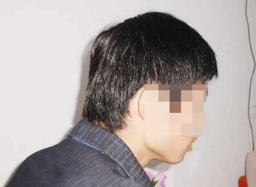小伙收听男子性病广播节目患上社交恐惧症