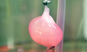 科学家“实验室培育肾”移植老鼠