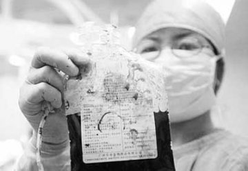 卫生部要求禁卖人胎盘 分娩后胎盘归产妇所有