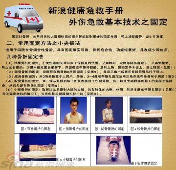 小夹板法：几种骨折固定法