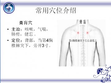 冬病夏治 三伏贴常用穴位介绍