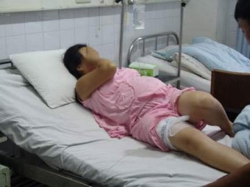 剧毒蜘蛛叮咬七月孕妇威胁腹中胎儿