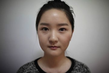 韩国摄影师记录5位模特血腥整容蜕变全程