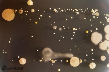 亲眼看看手机上的细菌