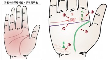 24种手相揭示疾病征兆
