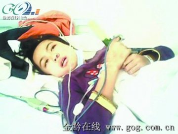 15岁少女患红斑狼疮生命垂危 肌体免疫能力为零