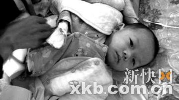 半岁男婴靠肚皮排泄 两万元手术费无处筹措