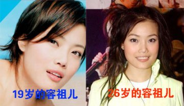 明星抗衰老的成败案例