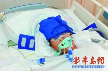 10岁男童头部被钉2个螺丝钉 医生称生还可能大