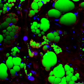 科学家研发可注射3D疫苗 可抵抗癌症传染病