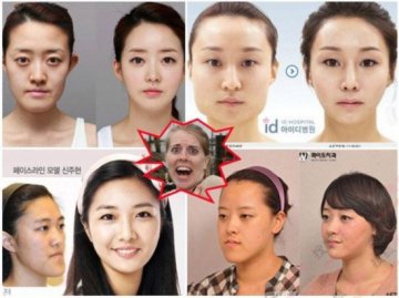 31个惊人韩国整容案例