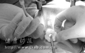 上海：悬吊式腹腔镜手术成功