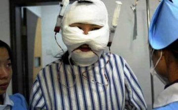 揭开变性手术神秘面纱 实拍男人变女人震撼全程