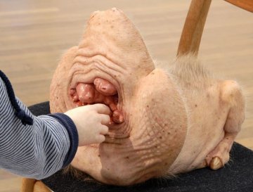 惊现“猪人”又是怪病？