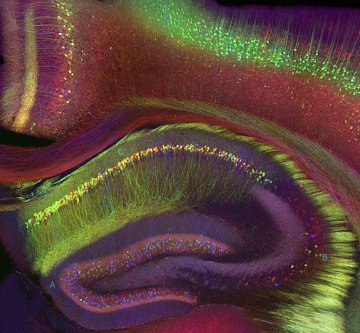 科学家发现大脑控制衰老秘密 或延长人类寿命