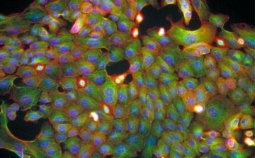 我国科学家利用纳米技术“光测”癌细胞