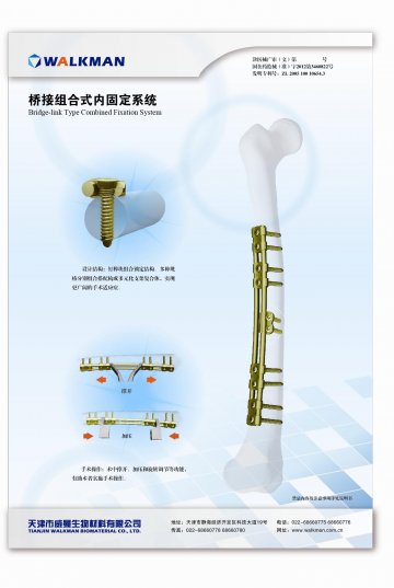桥接组合式内固定系统-桥接组合式内固定系统(国食药监械(准)字2012第3460822号)精美广告图欣赏