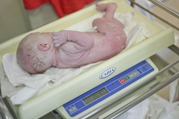 高清：直击年轻母亲剖腹产分娩全过程