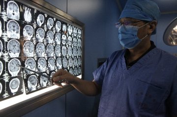 空军总医院多学科联动治疗晚期脑肿瘤