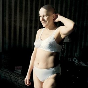 一个女人和癌症斗争全程