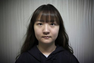 韩国摄影师记录5位模特血腥整容蜕变全程