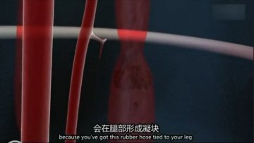 医学解读：男子腿绑香肠冒充阳物为何丧命