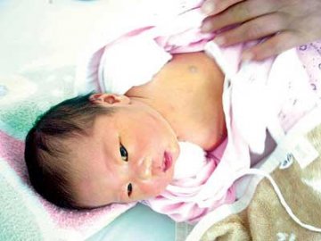 出生一夜婴儿锁骨就骨折 院方封存病例等待调查