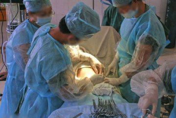 实拍：剖腹产手术全过程