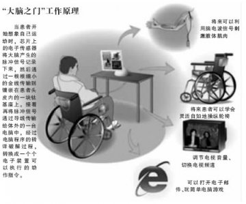 瘫痪小伙成全球首例仿生人 芯片遥控肢体运动