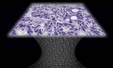 科学家研发薪型癌症细胞检测显微镜 无须配备镜头