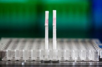 俄开发出尿液诊断早期癌症技术 1分钟可出结果