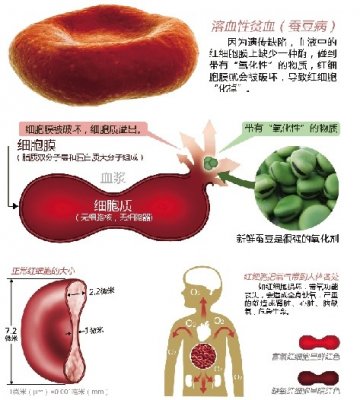 小孩连吃两天蚕豆险送命 专家：蚕豆是强氧化剂